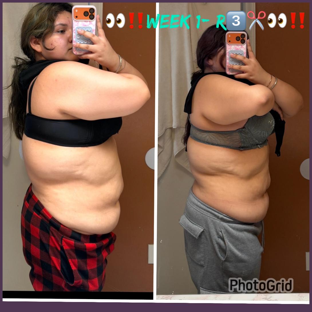 WEIGHT LOSS